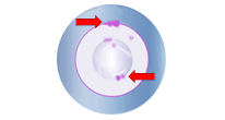 epoxy deposits on the core of the fiber optic