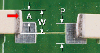 excess lateral overhang